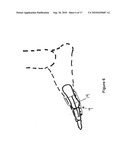 TOE BRACE DESIGNS diagram and image