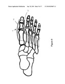 TOE BRACE DESIGNS diagram and image