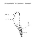 TOE BRACE DESIGNS diagram and image