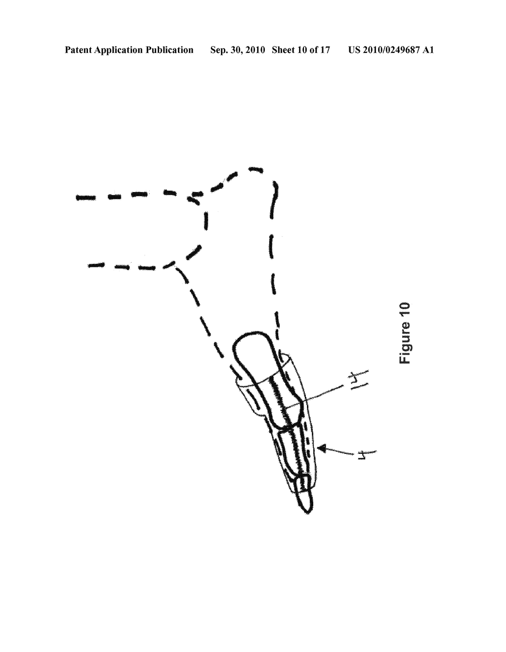 TOE BRACE DESIGNS - diagram, schematic, and image 11