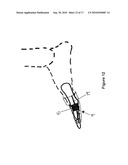 TOE BRACE DESIGNS diagram and image