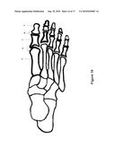 TOE BRACE DESIGNS diagram and image