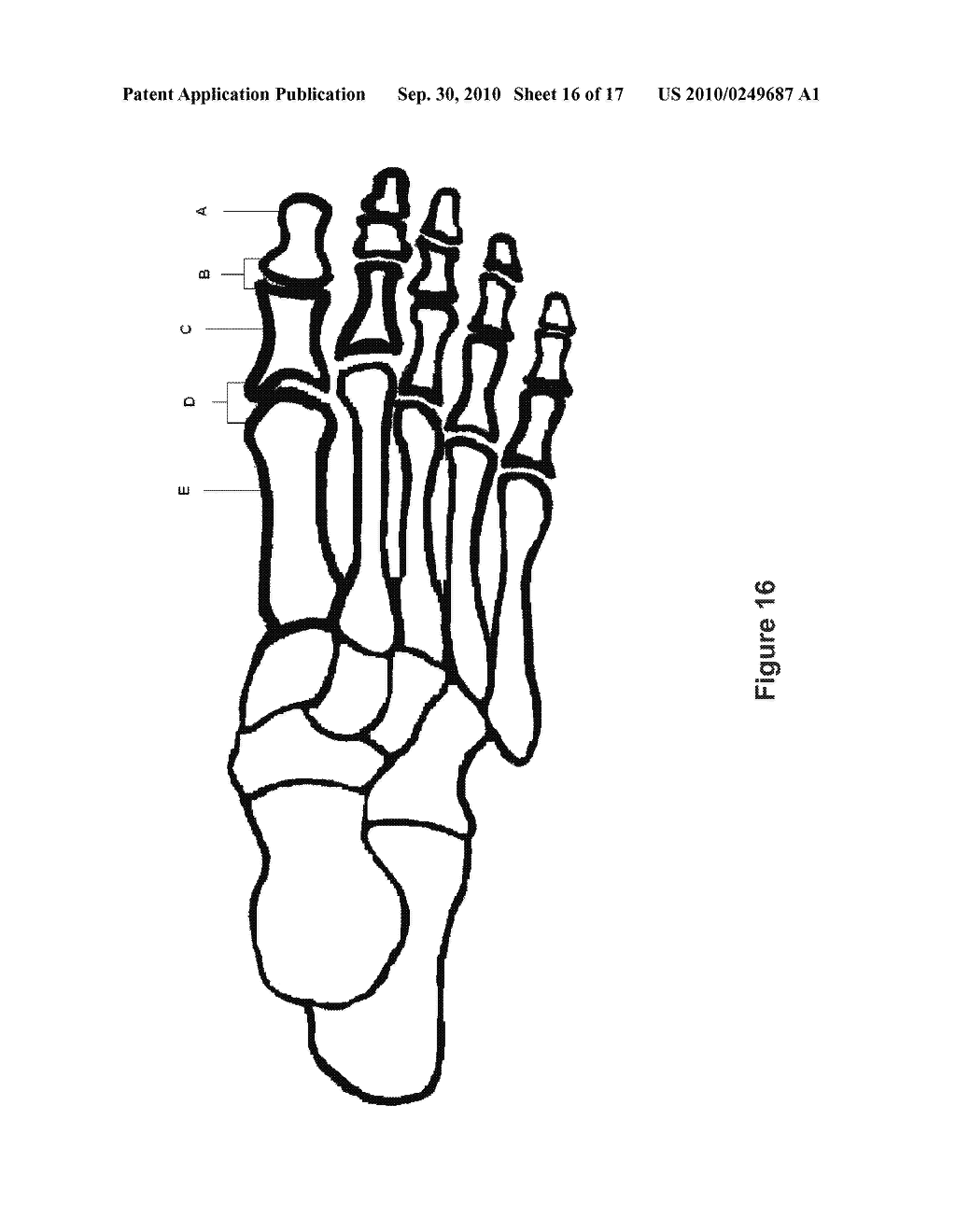 TOE BRACE DESIGNS - diagram, schematic, and image 17