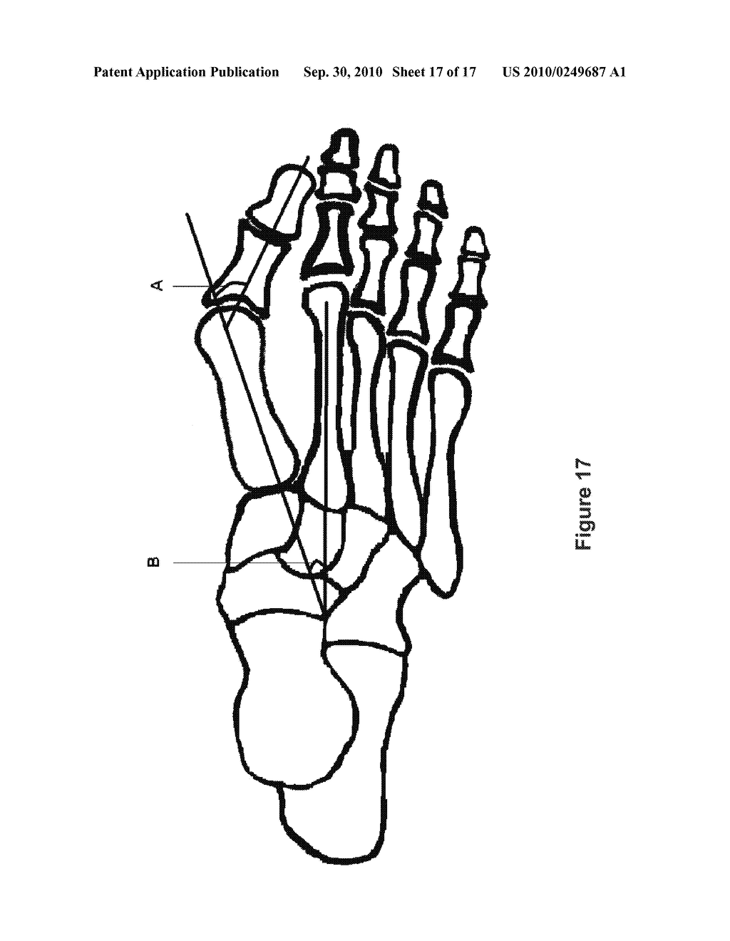 TOE BRACE DESIGNS - diagram, schematic, and image 18