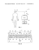 CASSETTE CAPTURE MECHANISM diagram and image