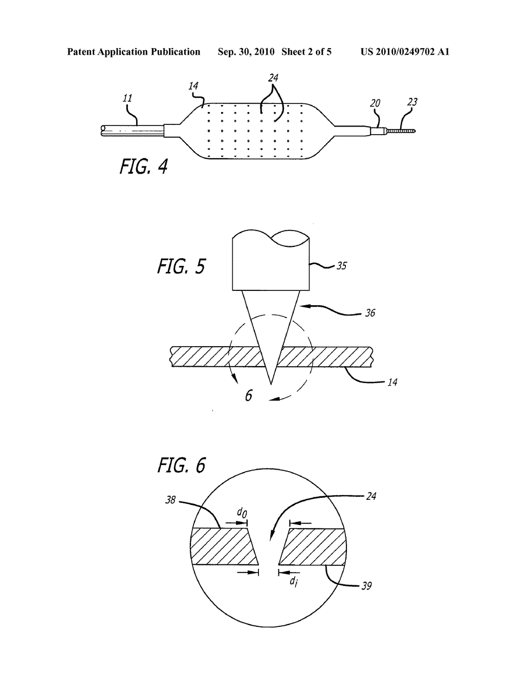 POROUS CATHETER BALLOON AND METHOD OF MAKING SAME - diagram, schematic, and image 03