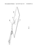 DEFORMABLE MEDICAL IMPLANT diagram and image