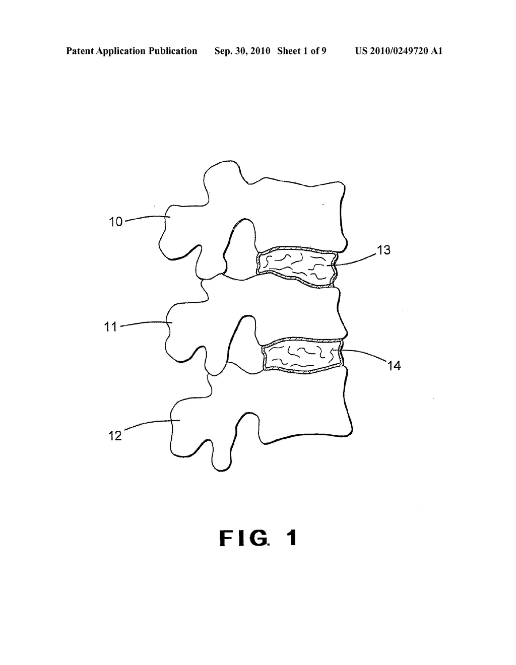 INTEGRATED DEVICE FOR THE STORAGE AND DELIVERY OF A BONE GRAFT OR OTHER IMPLANTABLE MATERIAL TO A SURGICAL SITE - diagram, schematic, and image 02