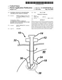 METHODS AND DEVICES FOR PREPARING AND IMPLANTING TISSUE SCAFFOLDS diagram and image