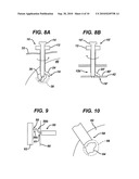 METHODS AND DEVICES FOR PREPARING AND IMPLANTING TISSUE SCAFFOLDS diagram and image