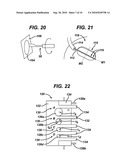 METHODS AND DEVICES FOR PREPARING AND IMPLANTING TISSUE SCAFFOLDS diagram and image