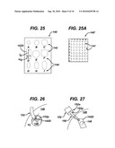 METHODS AND DEVICES FOR PREPARING AND IMPLANTING TISSUE SCAFFOLDS diagram and image