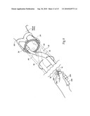 HANDLE ASSEMBLIES FOR INTRAVASCULAR TREATMENT DEVICES AND ASSOCIATED SYSTEMS AND METHODS diagram and image