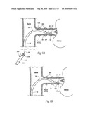 HANDLE ASSEMBLIES FOR INTRAVASCULAR TREATMENT DEVICES AND ASSOCIATED SYSTEMS AND METHODS diagram and image