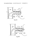 HANDLE ASSEMBLIES FOR INTRAVASCULAR TREATMENT DEVICES AND ASSOCIATED SYSTEMS AND METHODS diagram and image