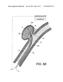 POLYMER COMPOSITES FOR BIOMEDICAL APPLICATIONS AND METHODS OF MAKING diagram and image