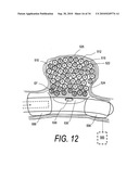 POLYMER COMPOSITES FOR BIOMEDICAL APPLICATIONS AND METHODS OF MAKING diagram and image