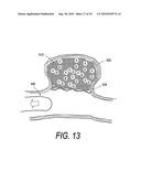 POLYMER COMPOSITES FOR BIOMEDICAL APPLICATIONS AND METHODS OF MAKING diagram and image