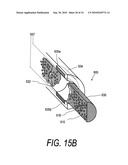 POLYMER COMPOSITES FOR BIOMEDICAL APPLICATIONS AND METHODS OF MAKING diagram and image