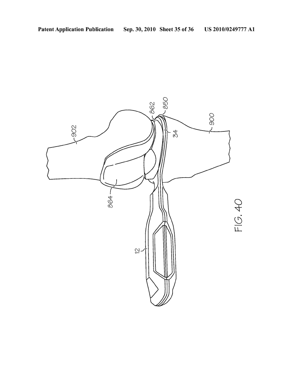 DEVICE AND METHOD FOR DETERMINING FORCES OF A PATIENT'S JOINT - diagram, schematic, and image 36