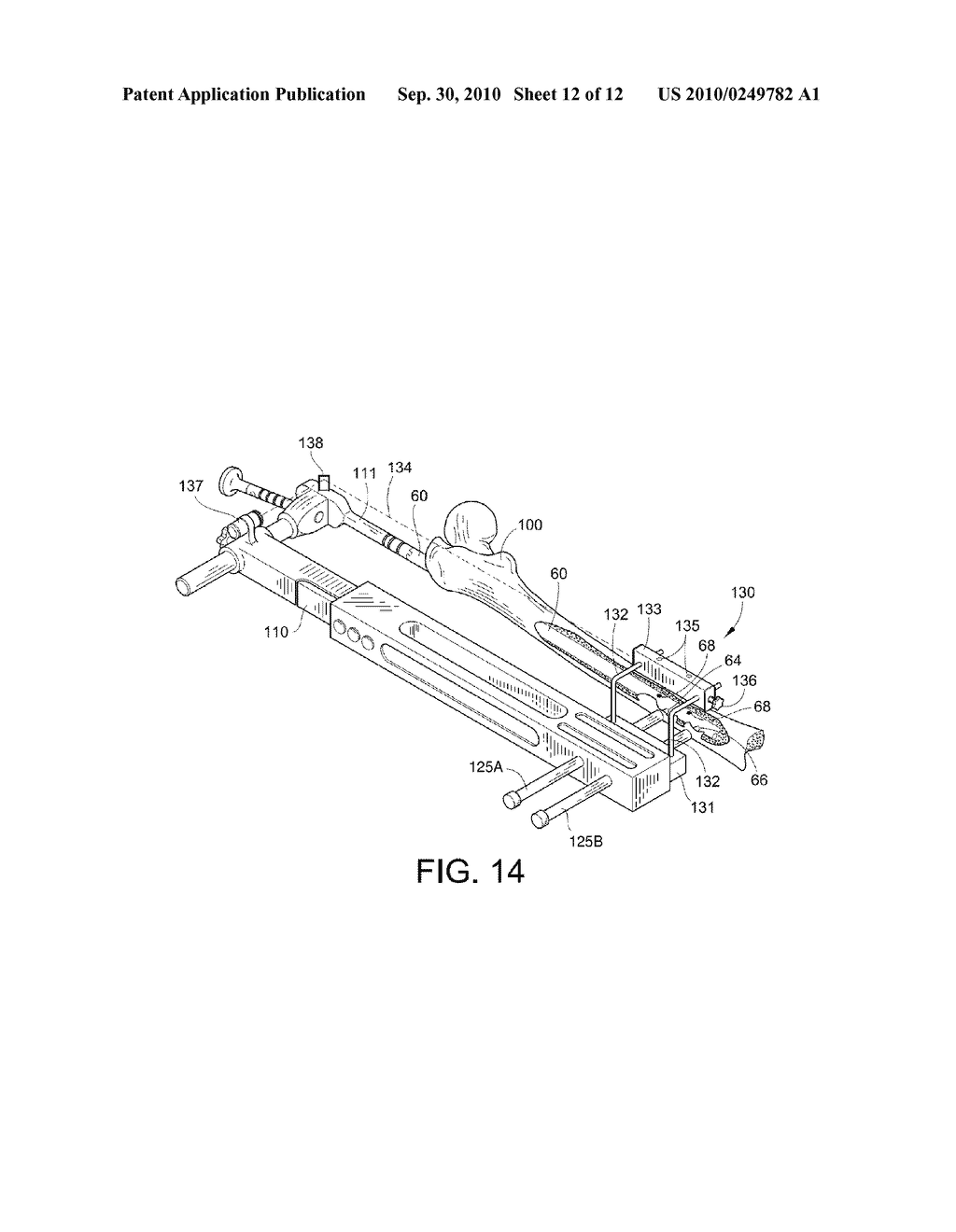 INTRAMEDULLARY NAIL TARGETING DEVICE - diagram, schematic, and image 13