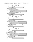 Cervical Motion Disc Inserter diagram and image