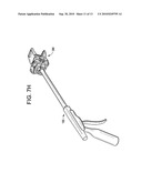 Cervical Motion Disc Inserter diagram and image