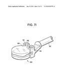 Cervical Motion Disc Inserter diagram and image