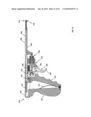 Insertion Instrument for Artificial Discs diagram and image