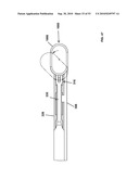 Insertion Instrument for Artificial Discs diagram and image