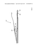 Insertion Instrument for Artificial Discs diagram and image