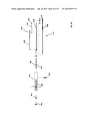 Insertion Instrument for Artificial Discs diagram and image