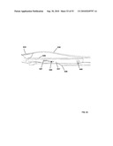 Insertion Instrument for Artificial Discs diagram and image