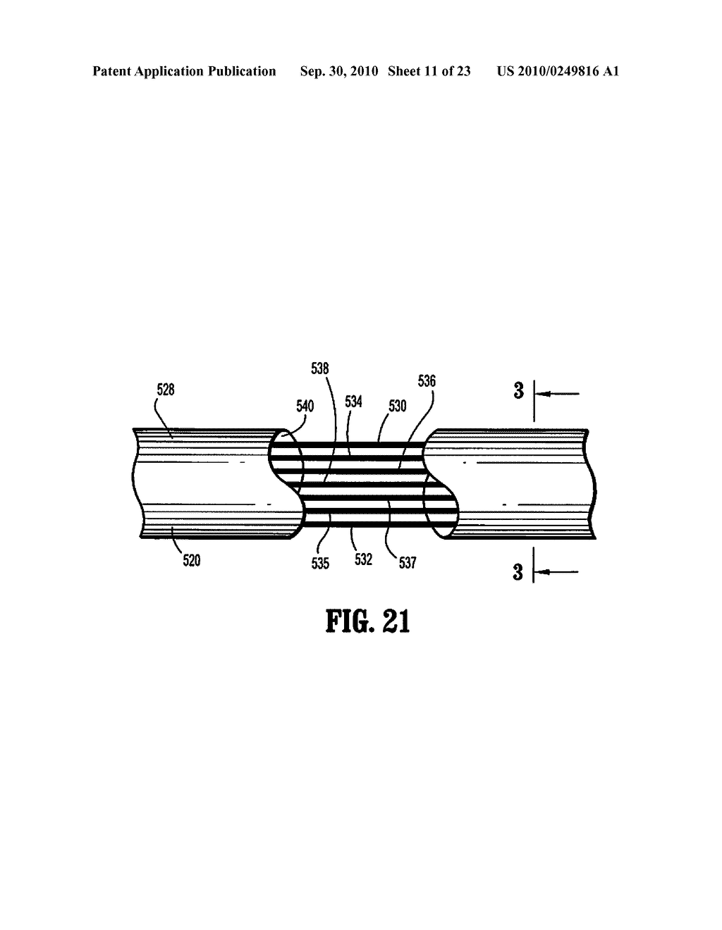 SURGICAL DEVICE - diagram, schematic, and image 12