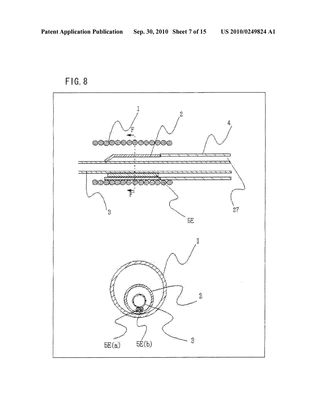 CATHETER - diagram, schematic, and image 08