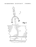 EXPANDABLE PLUGS AND RELATED DELIVERY APPARATUSES AND METHODS diagram and image