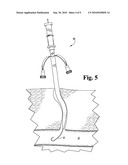 EXPANDABLE PLUGS AND RELATED DELIVERY APPARATUSES AND METHODS diagram and image