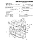 Multizone Implants diagram and image