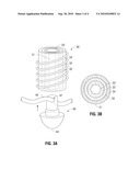 Multizone Implants diagram and image