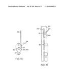 APPARATUS FOR MINIMALLY INVASIVE POSTERIOR CORRECTION OF SPINAL DEFORMITY diagram and image