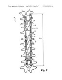 IMPLANTS FORMED OF A SHAPE MEMORY POLYMERIC MATERIAL FOR SPINAL FIXATION diagram and image