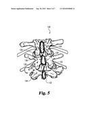 IMPLANTS FORMED OF A SHAPE MEMORY POLYMERIC MATERIAL FOR SPINAL FIXATION diagram and image