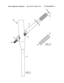 FRACTURE FIXATION DEVICE diagram and image