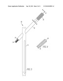 FRACTURE FIXATION DEVICE diagram and image