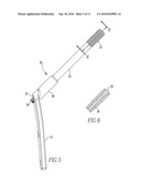 FRACTURE FIXATION DEVICE diagram and image