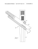 FRACTURE FIXATION DEVICE diagram and image