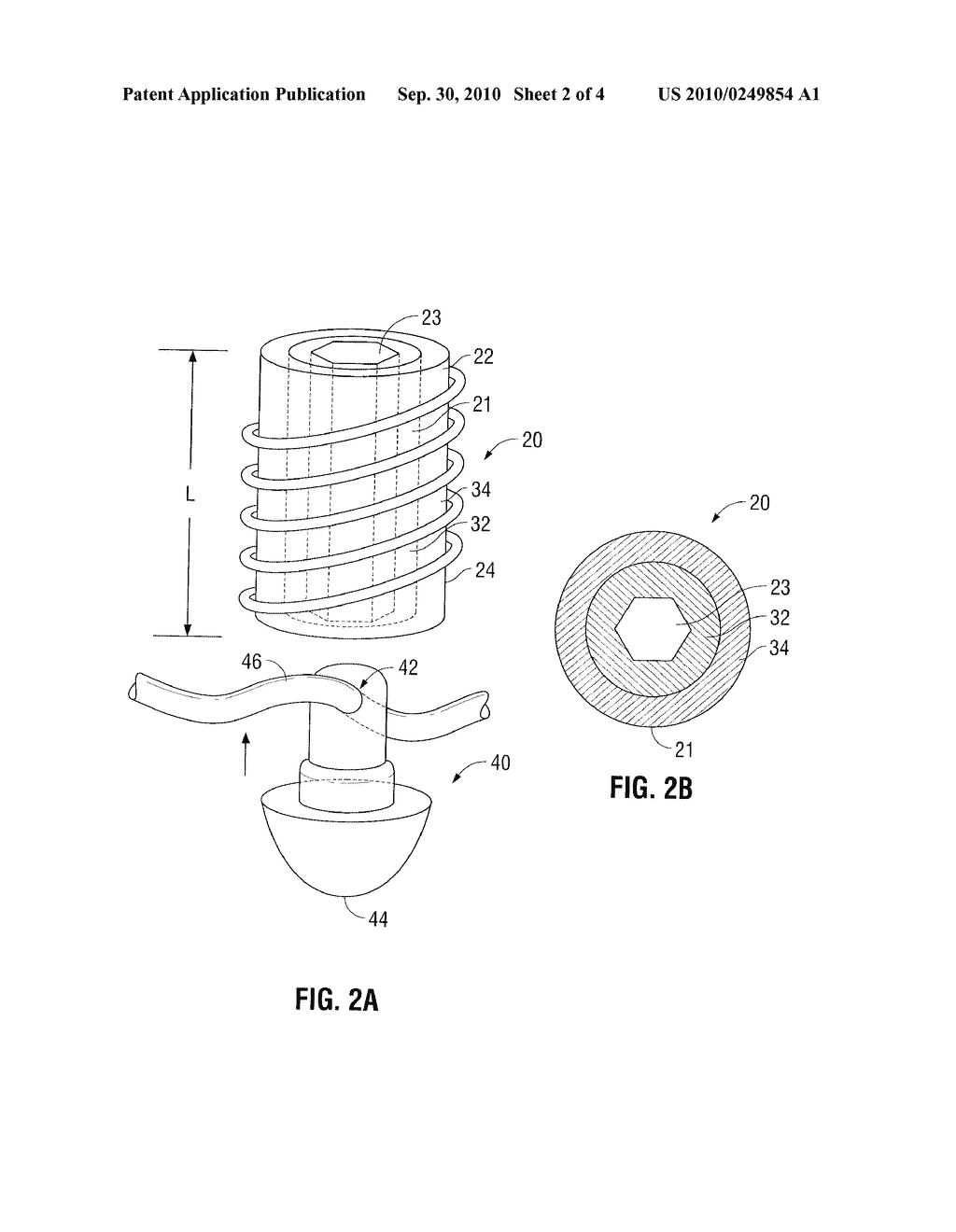 Multizone Implants - diagram, schematic, and image 03