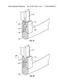 Devices and Methods for Inserting a Vertebral Fixation Member diagram and image