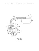 HEMODYNAMIC STABILITY ASSESSMENT BASED ON HEART SOUNDS diagram and image