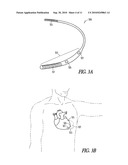 HEMODYNAMIC STABILITY ASSESSMENT BASED ON HEART SOUNDS diagram and image